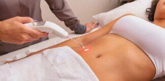 laserterapia